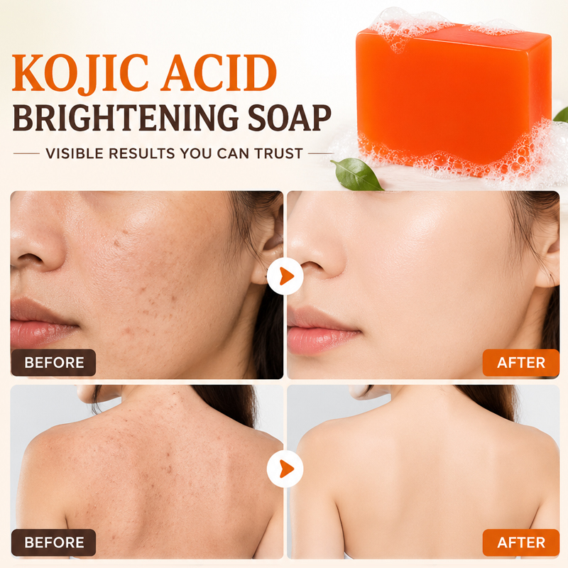 Sabun Asam Kojic 6 Buah, Mence - Glycolic Acid Exfoliant ulasan dan harga